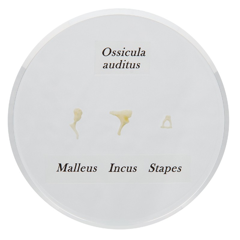 auditory ossicles embedded in clear acrylic