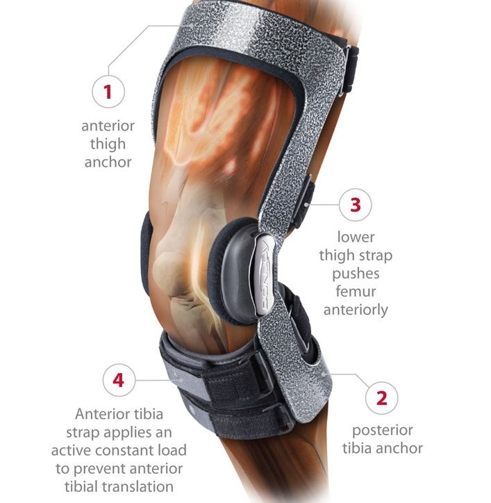 The Donjoy Armor Brace provides ACL relief with a Four Points of Leverage design
