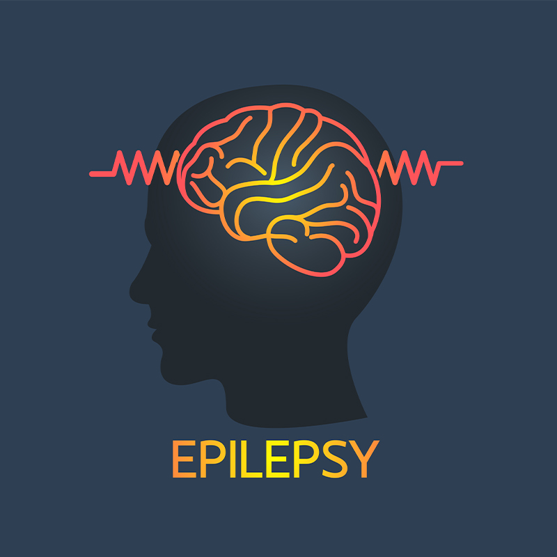 Best Epilepsy Aids 2024
