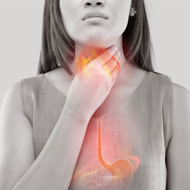 How to Prevent Acid Reflux at Night