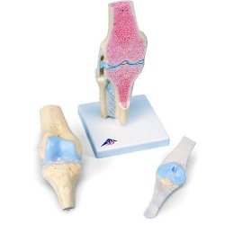 Sectional Knee Joint Model 3 Part