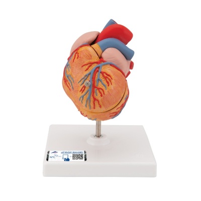 3B Scientific 2-Part Anatomical Heart Model with Left Ventricular Hypertrophy