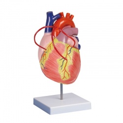 Enlarged Heart Bypass Model