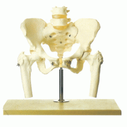 Pelvis with Lumbar Spine and Femoral Head