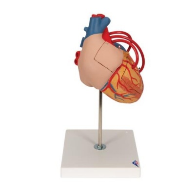 Human Heart with Bypass Anatomical Model (2 x Lifesize with Four Parts)