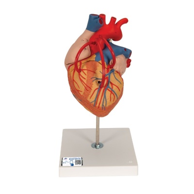 Human Heart with Bypass Anatomical Model (2 x Lifesize with Four Parts)