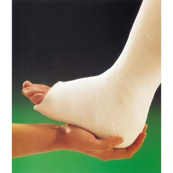 It is also used to make plaster casts to immobilize broken bones while they heal, though many modern orthopedic casts.