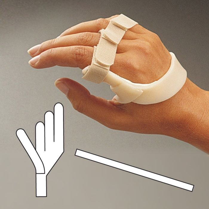 Ulnar Deviation Splint