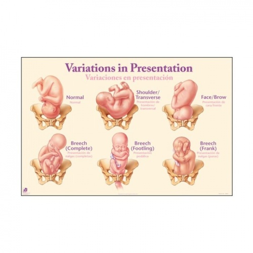 labor stages