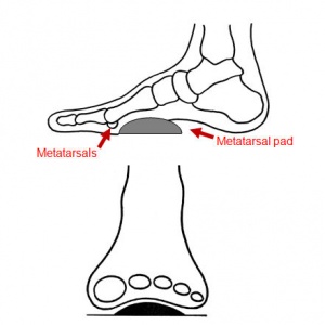 Pedag T-Form Metatarsal Supports