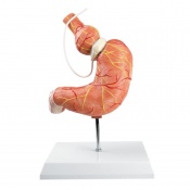 Anatomical Model of Stomach with Gastric Band