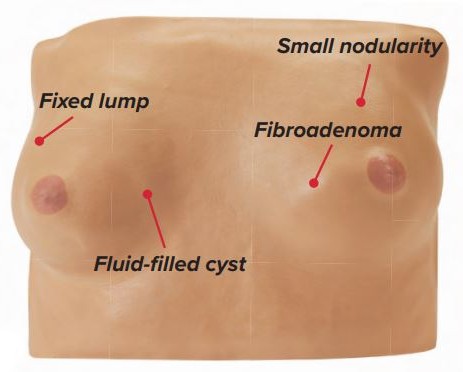 Simulaids-Breast-Examination-Simulator