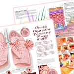 Disease Charts