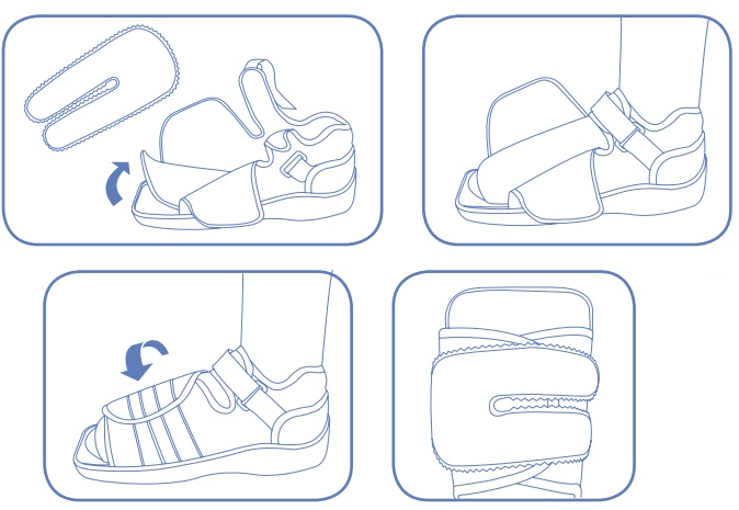 Jura Post-Operative Shoe Wearing Guide