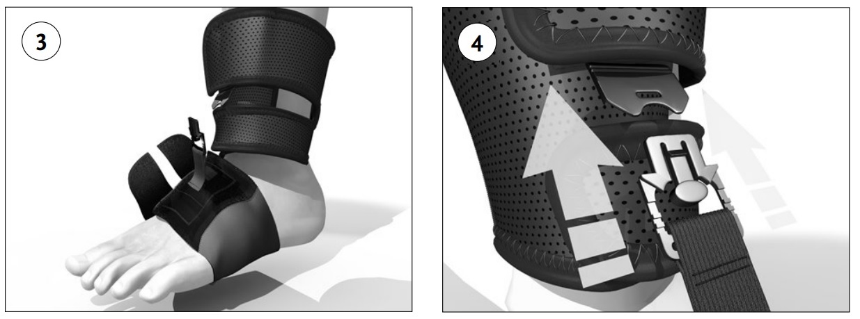 Fitting Ossur Foot Up Support Shoeless Attachment