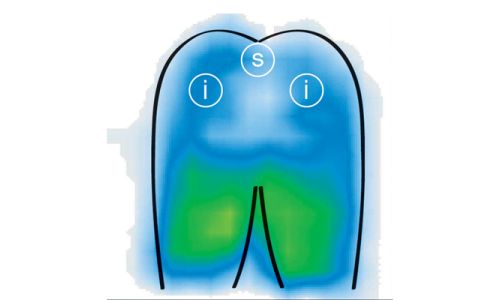 The Systam Cushion Provides Relief When Sat Down Systam Pressure Relief Cushion