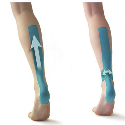 Ultimate Guide: How To Apply Kinesiology Tape