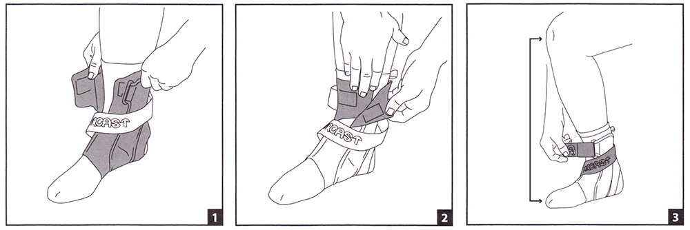 Aircast A60 Fitting Instructions Aircast A60 Fitting Instructions