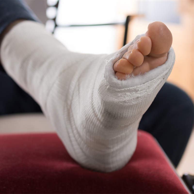 Best Broken Ankle Recovery Tips :: Sports Supports ...