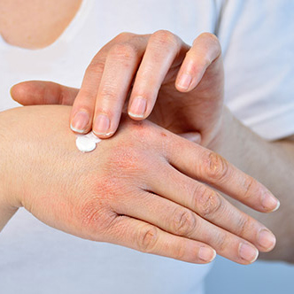 Dry and Cracked Hands? Four Remedies You Haven't Tried 2022