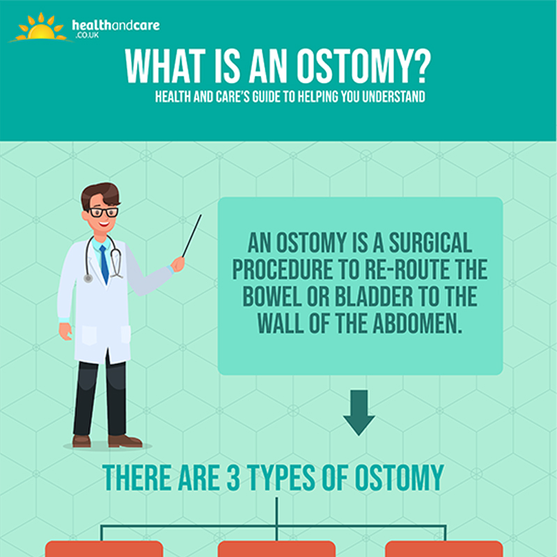 Learn All Things Ostomate with Our Ostomy Infographic