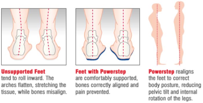 orthotic insoles nhs