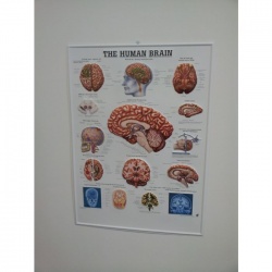 3D Human Brain Poster