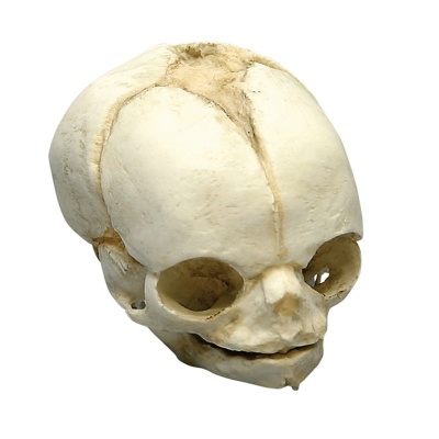 Foetal Skull 21 1/2 Weeks
