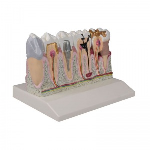 Enlarged Dental Model