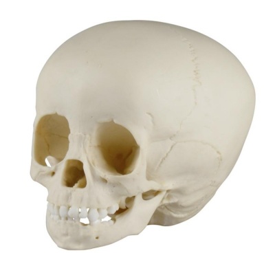 Paediatric Skull 1 1/2 Year Old