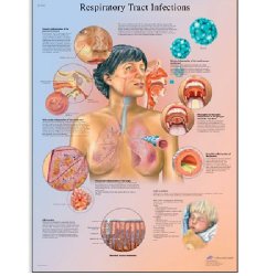 Respiratory Tract Infections Chart