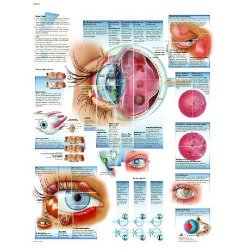 Diseases Of The Eye 3d Anatomical Charts at Best Price in Mumbai | Sms Scientific Products Pvt Ltd Diseases Of The Eye 3d Anatomical Charts at Best Price in Mumbai | Sms Scientific Products Pvt Ltd