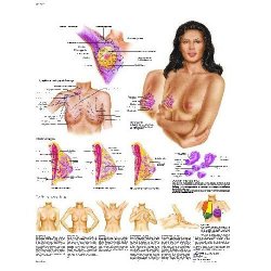 The Female Breast Chart Anatomy Pathology And Self-Examination