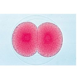 Sea Urchin Embryology Psammechinus Miliaris - English Slides