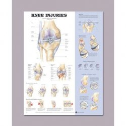 Anatomical Chart for Knee Injuries