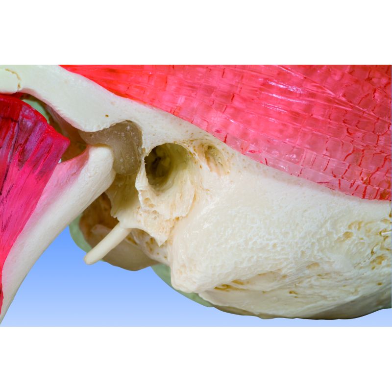 Bonelike Human Skull Model Half Transparent And Half Bony 8 Part ...