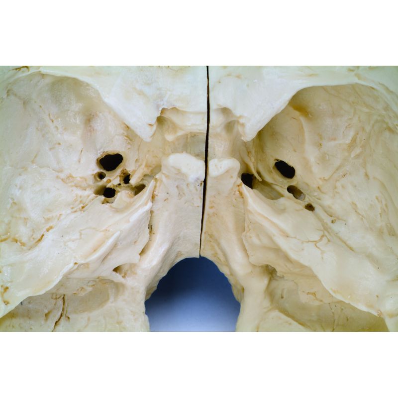 Bonelike Human Skull Model Half Transparent And Half Bony 8 Part ...