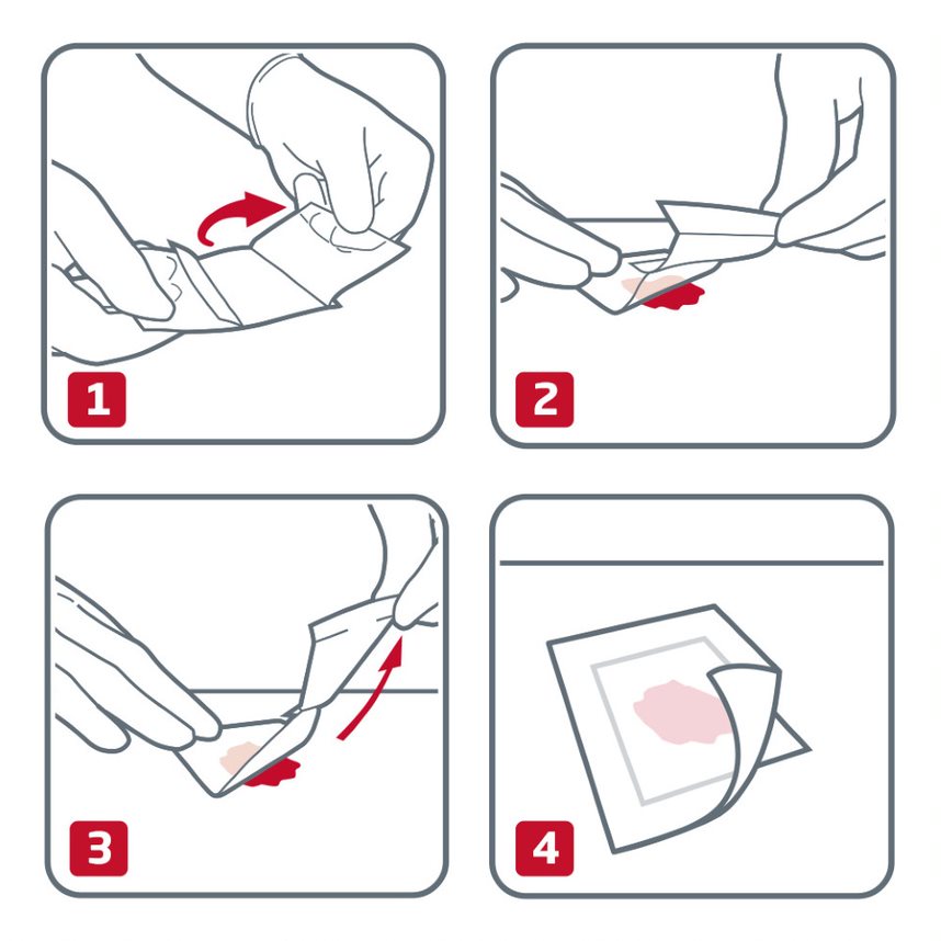Image shows instructions for application of leukoplast cuticell dressing