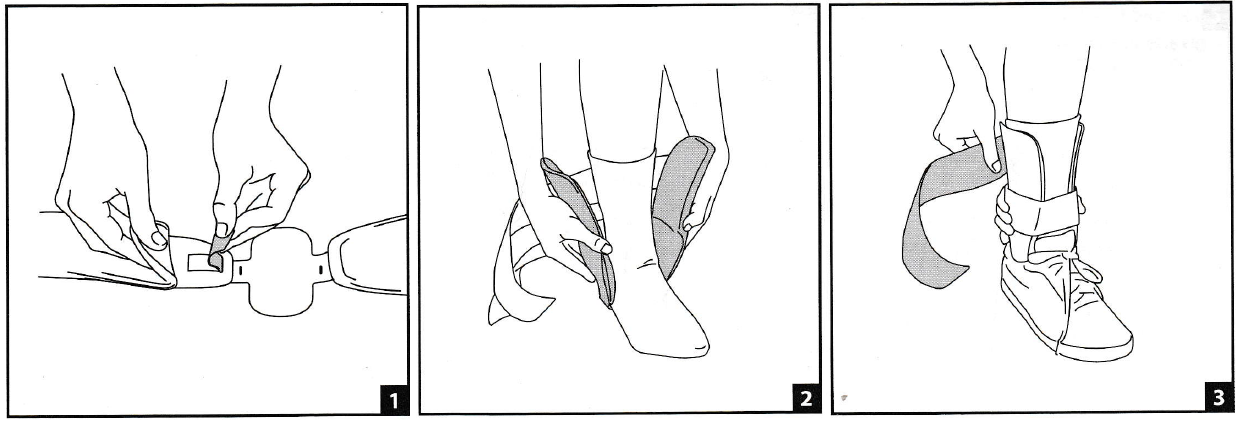 Aircast Air-Stirrup Universe Ankle Brace Fitting Instructions Aircast Air-Stirrup Universe Ankle Brace Fitting Instructions