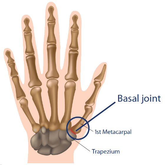 CMC And Basal Joint Location Image