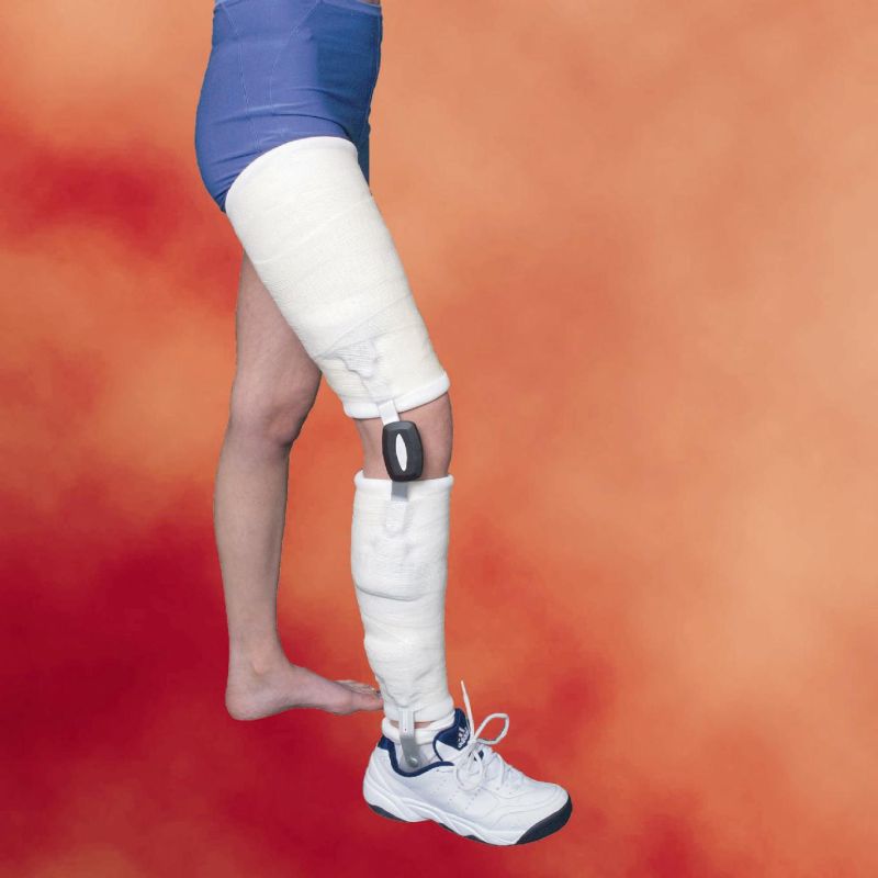 dc monopivotal knee cast