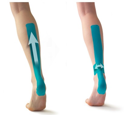 How to Apply Kinesiology Tape for Achilles Tendon