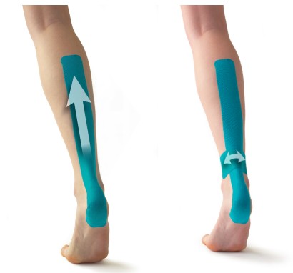 Should I Use Kinesio Tape?