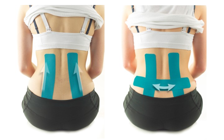 How to Apply Kinesiology Tape for Back Pain