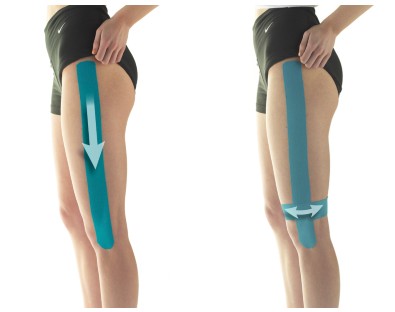 How to Apply Kinesiology Tape for IT Band Pain