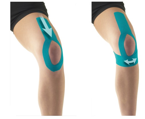 To Apply Kinesiology Tape | Health and Care