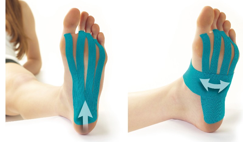 Kt tape wrap sales for plantar fasciitis