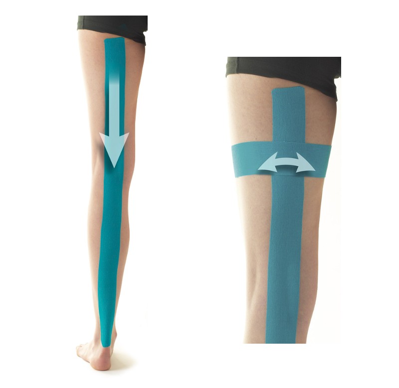 How to Apply Kinesiology Tape for Sciatica