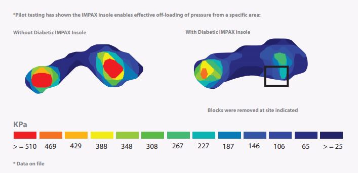 Impax Grid Insole for the ProCare Off-Loading Diabetic Shoe | Health ...