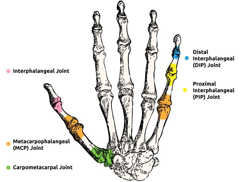 The Bedford splint supports the PIP and DIP joints of the finger The Bedford splint supports the PIP and DIP joints of the finger